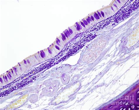 Layers Of Trachea Wall Photograph By Jose Calvoscience Photo Library