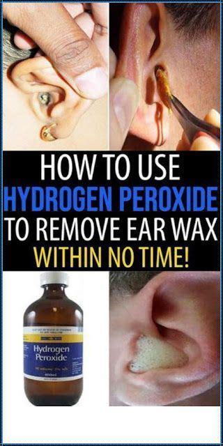 How To Use Hydrogen Peroxide To Remove Ear Wax In 2020 Ear Cleaning