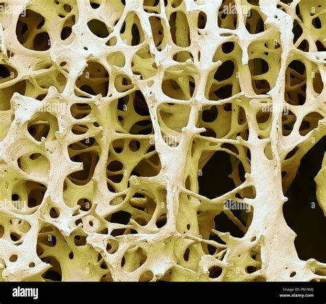 Spongy Bone Under Microscope