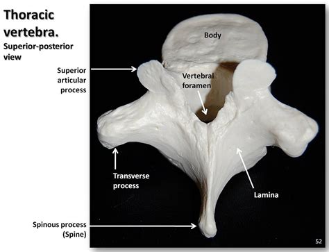 Thoracic Vertebra Posterior Superior View With Labels Axial Skeleton