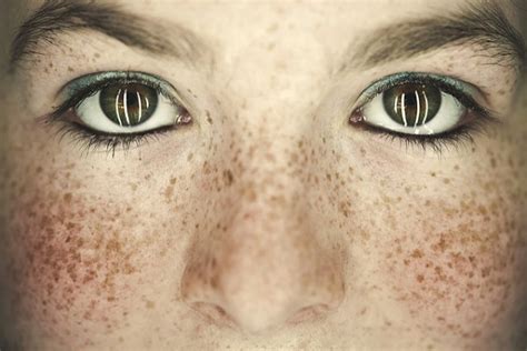 15 Fantastic Freckle Photos Updated