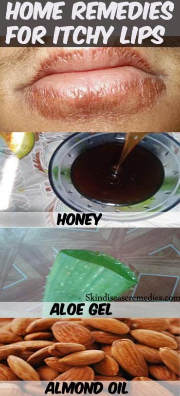 7 Home Remedies For Itchy Lips Cure For Chapped Lips Chapped Lips