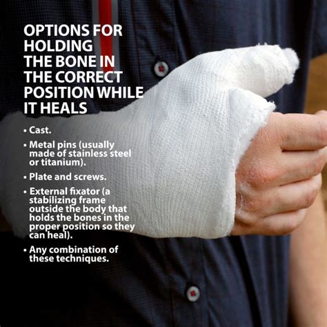 Colles Fractures Broken Wrist Florida Orthopaedic Institute