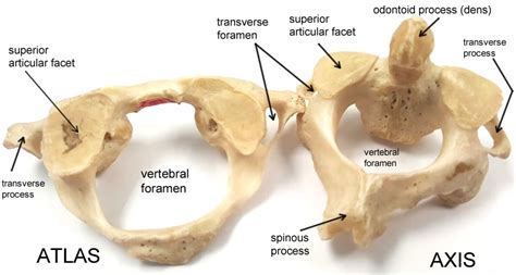 Atlas Vertebrae Anatomy
