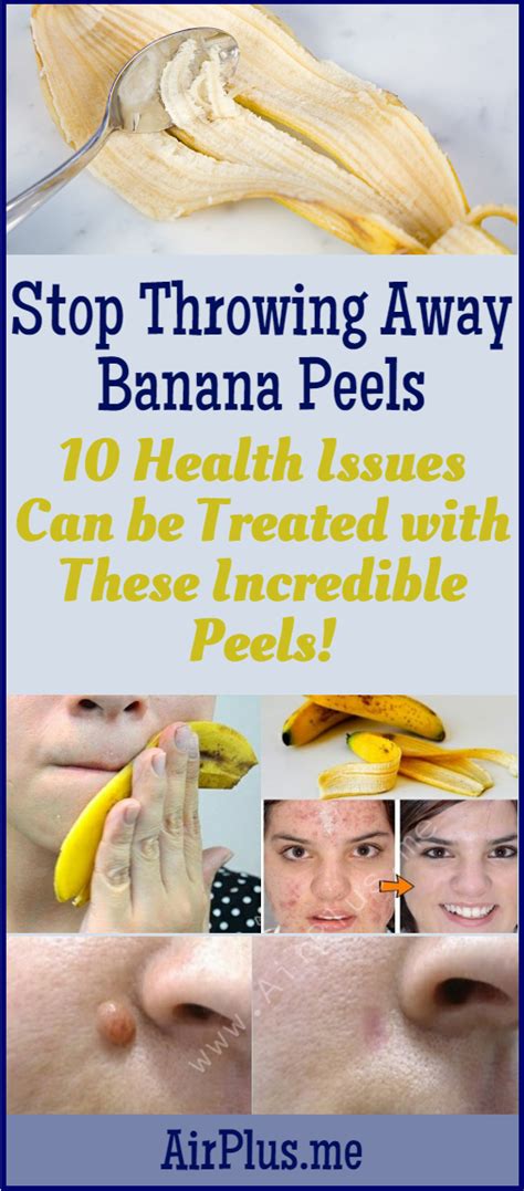 Stop Throwing Away Banana Peels 10 Health Issues Can Be Treated With