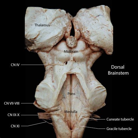 28 Which Part Of The Brainstem Contains The Cerebral Peduncles 