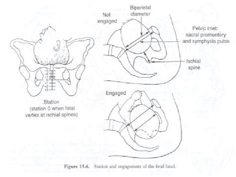 6normal Labordelivery And The Puerperium