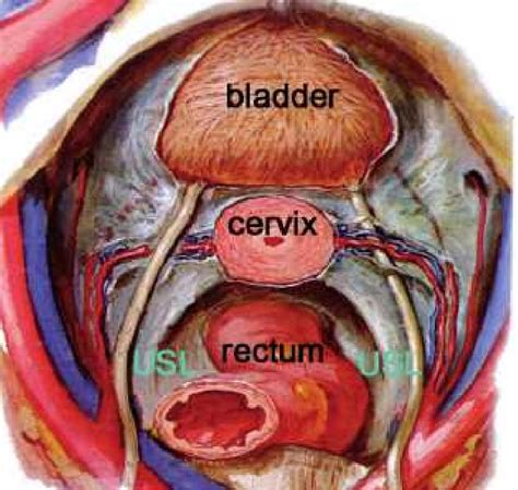 uterus diagram in body