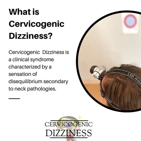 What Is Cervicogenic Dizziness Cervicogenic Dizziness