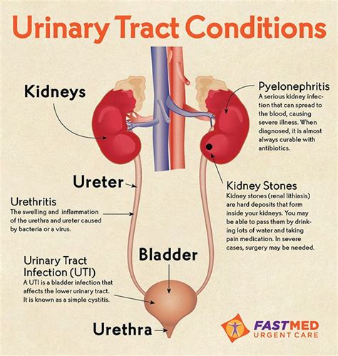 Urinary Tract Conditions Infographic Urinary Tract Urinary Tract Infection Womens Health Care