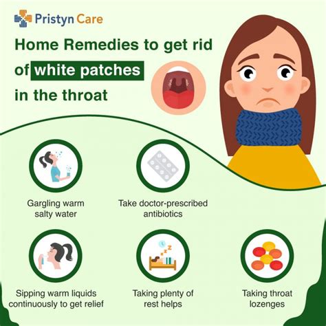A Must Read For White Spots On The Throat Doctors Advice