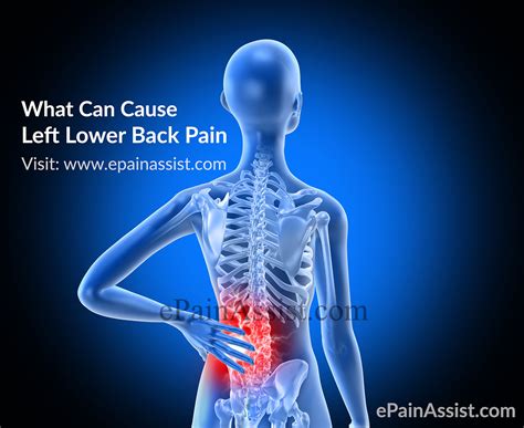 Left Side Back Pain