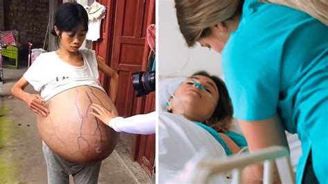 Woman With Giant Belly Shocked When Doctor’s Realize What’s Growing Inside Of Her Youtube