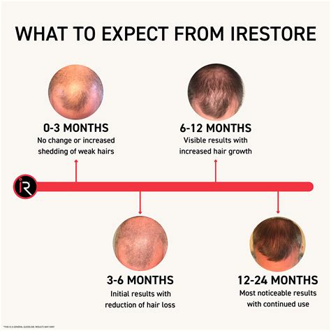 Irestore Essential Laser Hair Growth System Fda Cleared Hair Growth