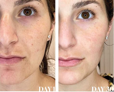 Isagenix Collagen Elixir Before And After Collection Collagen Beauty