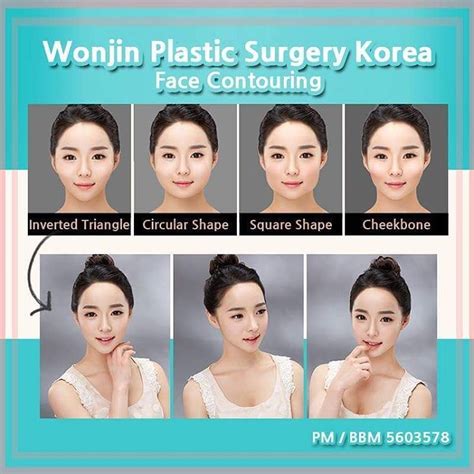 korean best face contouring plastic surgery wonjin beauty medical group korea get your egg