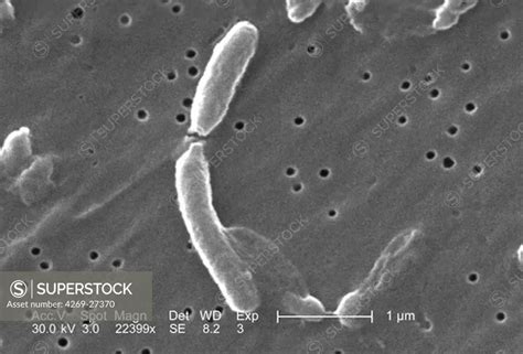 Vibrio Cholerae Scanning Electron Micrograph Sem Of Vibrio Cholerae