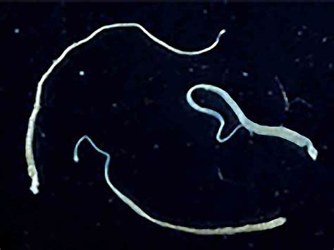 Tapeworm May Have Spread Cancer Cells To Colombian Man Consumer