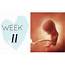 11 Weeks Pregnant  Pregnancy Week By Symptoms OHbaby