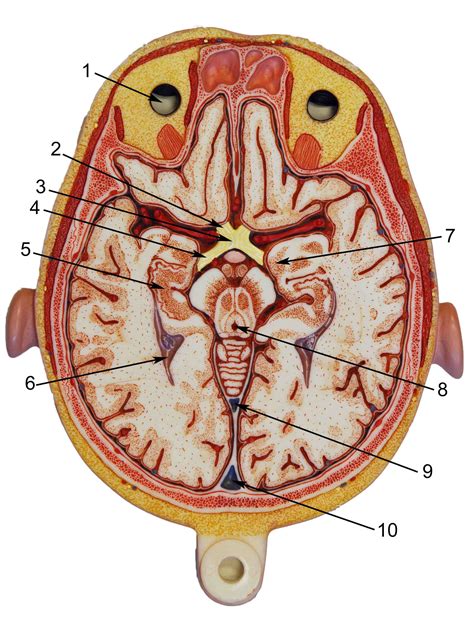 Brain Axial Section