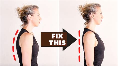 Fix Your Posture In 5 Minutes How To Fix Rounded Shoulders Youtube