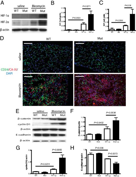 Increased Activation Of Hifs And Increased Wntβ Catenin Signaling In