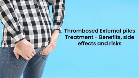 Thrombosed External Piles Treatment Its Benefits Side Effects