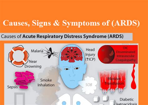 Ards nursing lecture (acute respiratory distress syndrome) with free quiz to help nursing students prep for nclex. Causes of Acute respiratory distress syndrome (ARDS ...