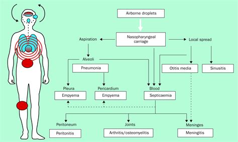 References In Streptococcus Pneumoniae Colonisation The Key To