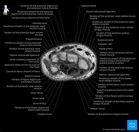 .magnetic resonance imaging (mri) or ultrasound imaging (usi) (soysa et al., 2012; Foot Muscles Mri Anatomy : Anatomy Of The Foot And Ankle ...