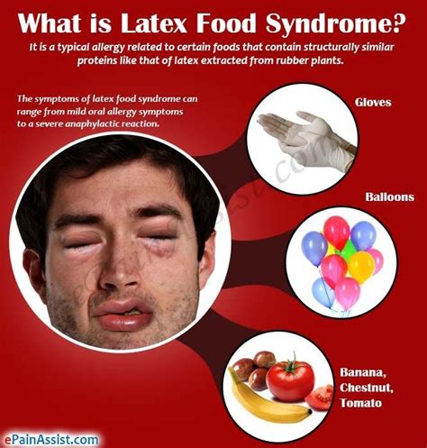 What are the signs & symptoms of a food allergy? Pin on Allergy Symptoms