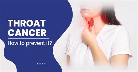 Throat Cancer Symptoms Risk Factors Treatments And More