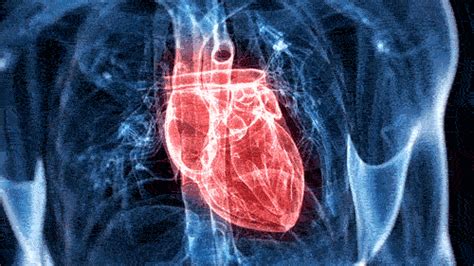 Cardiopatía En Mujeres La Importancia De Derribar Un Mito Bayer