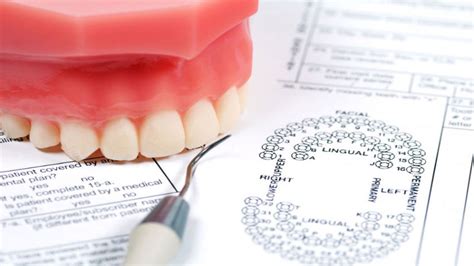 Dentists charge depending on the treatment required, unless. How General Dentists Help With Wisdom Tooth Trouble ...