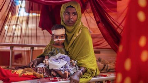 350000 Somali Children Face Starvation Un Pars Today