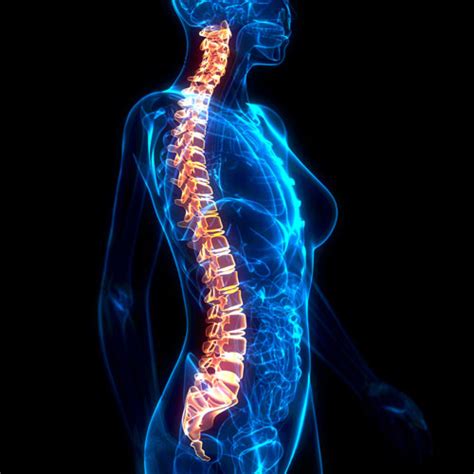 What Are My Options For Scoliosis Pain Relief Bay Area Scoliosis Center