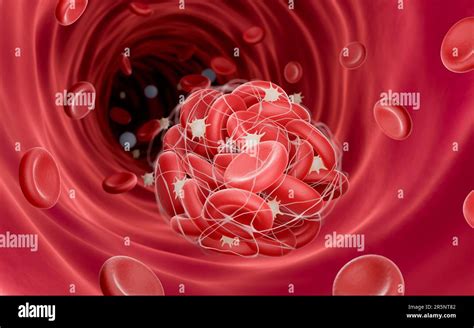 Blood Clot Illustration Stock Photo Alamy