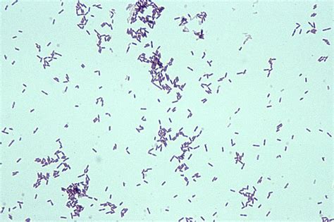 Gram Positive Bacilli Rods Microbiology Learning The