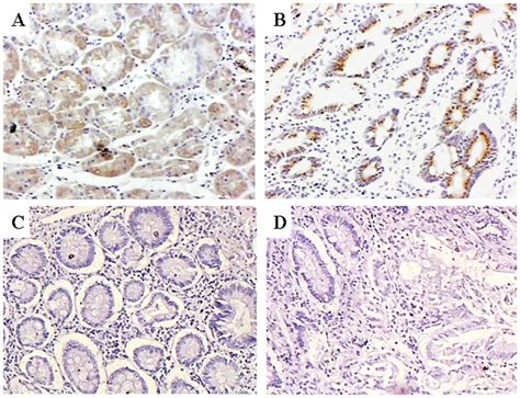 Representative Immunohistochemical Staining In Serial Sections Of