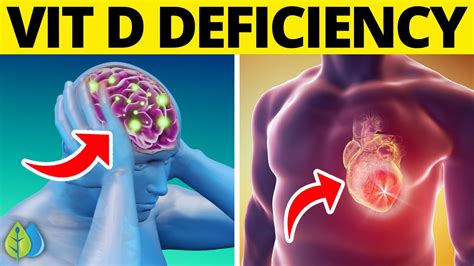 Top 13 Vitamin D Deficiency Symptoms You Need To Know