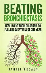 Bronchiectasis Treatment Mayo Clinic Photos