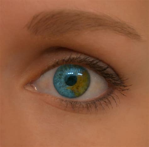 Sectoral Heterochromia By Smokeylittleclover On Deviantart