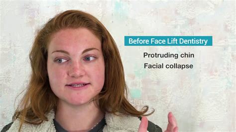 How To Fix A Protruding Chin Without Surgery Youtube