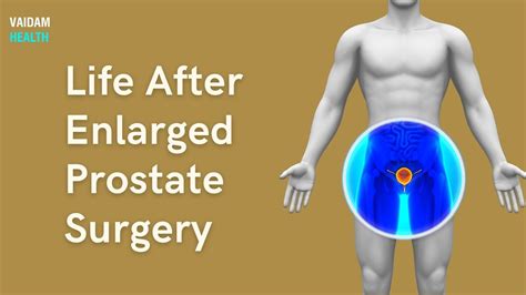 Life After Enlarged Prostate Surgery Youtube