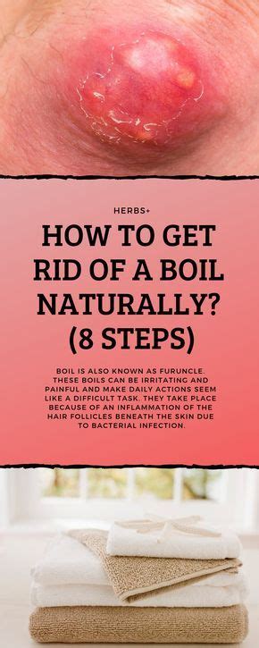 To learn about the recipe of preparing the. How To Get Rid of a Boil Naturally? (8 Steps) | Natural ...