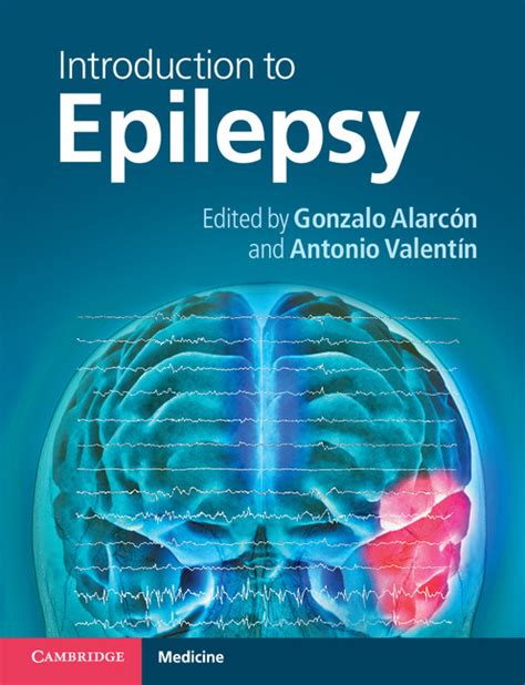 Introduction To Epilepsy