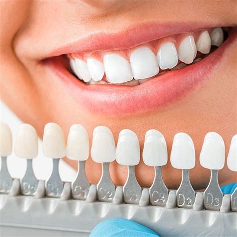 Odontologia Cosmetica Biodental Nicaragua La Mejor Clínica Dental