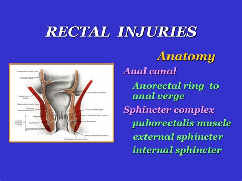 Ppt Colon Rectum Injuries Powerpoint Presentation Free Download Id