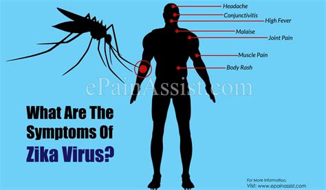 Guide To Zika Virus