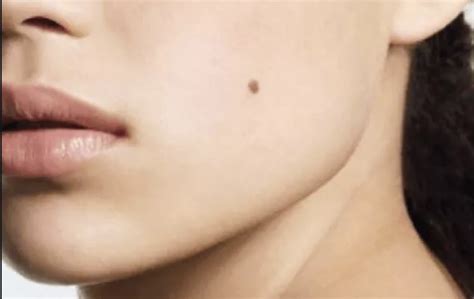 These Are The Secret Meaning Of The Moles In Each Area Of Your Face And